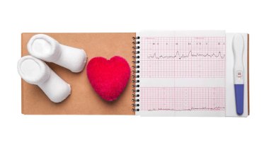 Elektrokardiyografi, yakın çekim. Defter hamile. Bir doktor danışmanlık sonucu.