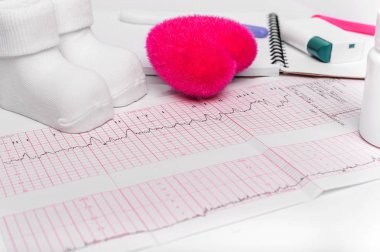 Elektrokardiyografi, yakın çekim. Defter hamile. Bir doktor danışmanlık sonucu.