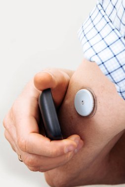 Sensör muayenesi şekeri olmadan kan glikoz düzeyi ile dijital bir şeker ölçüm test adam. Şeker hastalığı tedavisi.