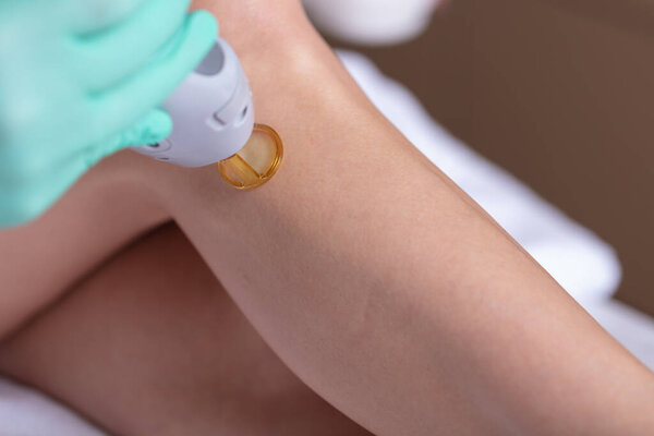 Laser hair removal with a modern device on the arm and leg of a young and beautiful woman. Hair removal by laser surgery