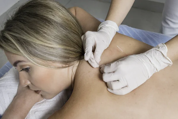 The doctor sticks needles into the blonde girl\'s body on the acupuncture.
