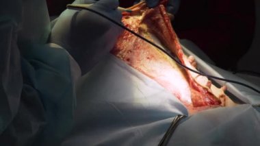 Veteriner kliniğinde bir köpeğin cerrahi müdahalesi