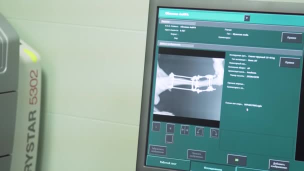 Doctor looking at an x-ray in a hospital — Stock Video