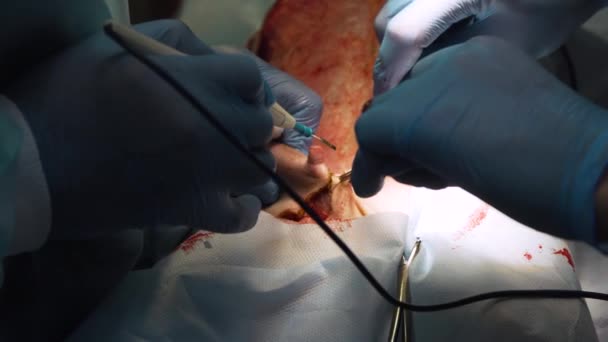 Chirurgische Operation eines Hundes in einer Tierklinik — Stockvideo