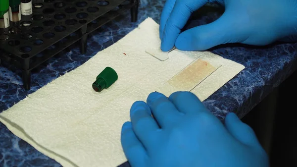 Análise de amostras de sangue em laboratório — Fotografia de Stock