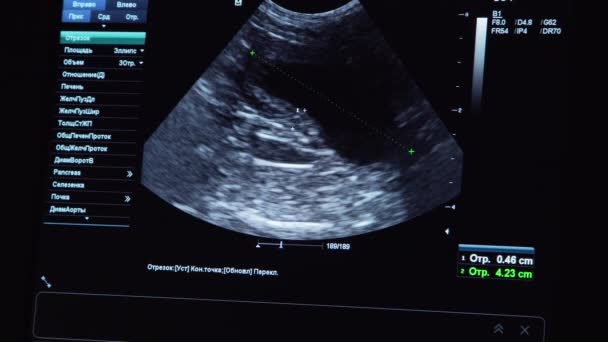 Veteriner kliniğinde ultrason teşhisi. — Stok video