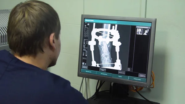 Läkaren tittar på en röntgenbild på sjukhus — Stockfoto