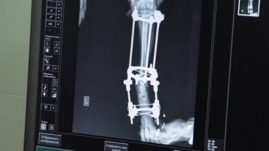 Doktor Röntgen bir hastanede bakarak