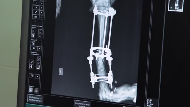 Doctor looking at an x-ray in a hospital — Stock Video