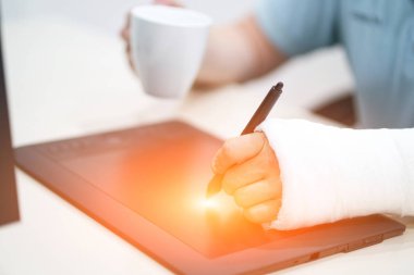 Kırık kollu sanatçı grafik tabletile bir şeyler çiziyor. Alçı alçı kırık kol kalem tutun.