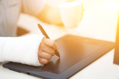 Kırık kollu sanatçı grafik tabletile bir şeyler çiziyor. Alçı alçı kırık kol kalem tutun.