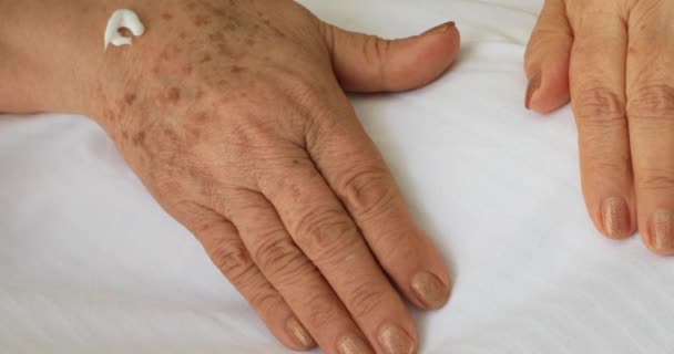 Old Female Hands Full Freckles — Stock Video