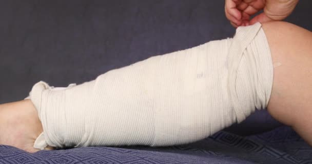Mujer Quitando vendajes de su pierna después de la operación de la vena varicosa — Vídeo de stock