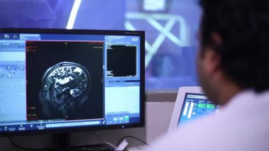 Beyin taraması monitörde resimleri. Manyetik rezonans görüntüleme MRG tıbbi klinikte araştırma.