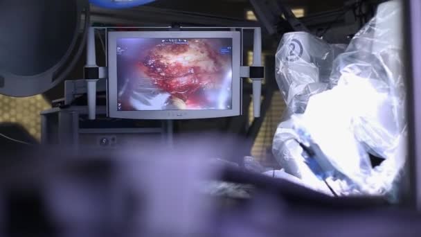 Medische Operatie Waarbij Robot Medische Robot Robotica Chirurgie — Stockvideo