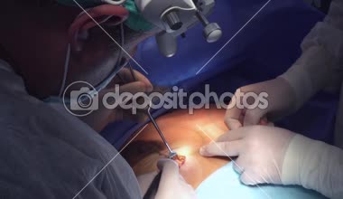 Cerrahi meme büyütme. Bir meme implantı montajı. Ameliyathane cerrahisinde meme büyütme cerrahisi implant aletleri. 