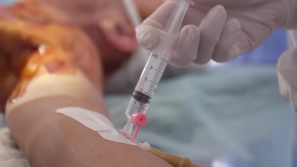 Anesthesie Door Katheter Chirurgische Borstvergroting Installatie Van Een Borstimplantaat — Stockvideo