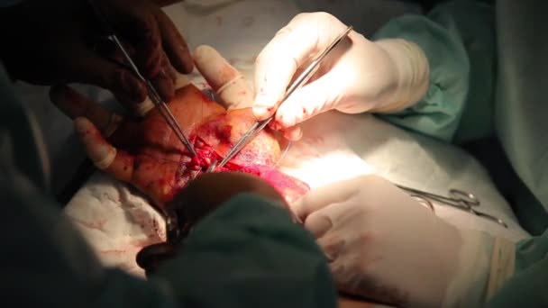 손목을 바느질하는 의사와 복원합니다 손목에 신경과 힘줄을 바느질하는 — 비디오