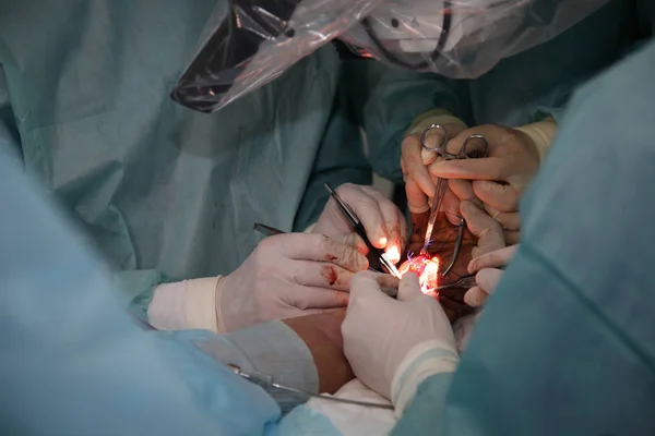 Cirurgia Para Coser Pulso Equipe Neurocirurgiões Traumatologistas Restaura Mão Cirurgia — Fotografia de Stock