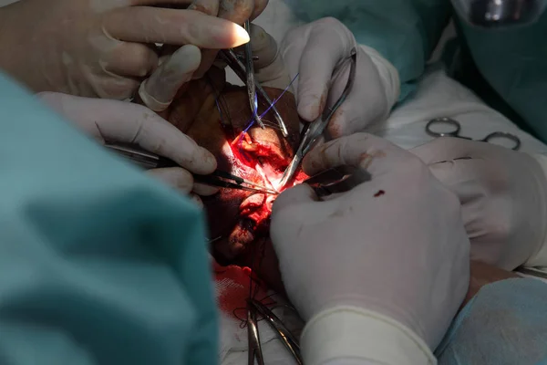 Χειρουργική Επέμβαση Για Ράψει Τον Καρπό Ομάδα Των Νευροχειρουργών Και — Φωτογραφία Αρχείου