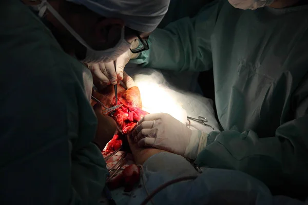 Cirugía Para Coser Muñeca Equipo Neurocirujanos Traumatólogos Restaura Mano Cirugía —  Fotos de Stock