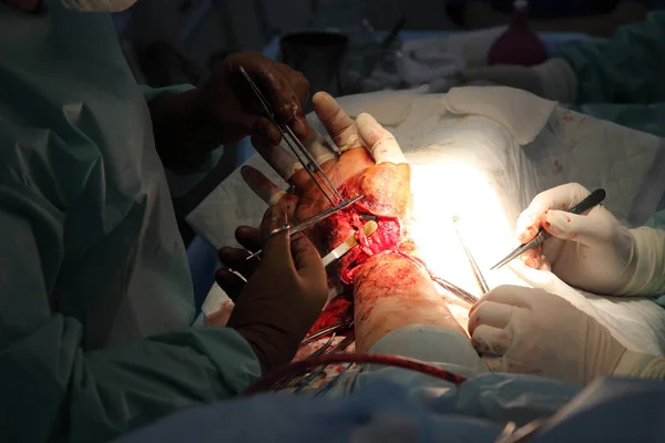 Cirugía Para Coser Muñeca Equipo Neurocirujanos Traumatólogos Restaura Mano Cirugía —  Fotos de Stock