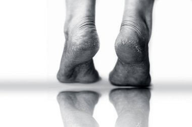 Beyaz arka planda iki kuru ayak, yakın plan.  