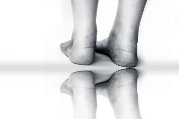 Närbild av kvinnlig ben eller häl visar torkade spruckna hälen med — Stockfoto