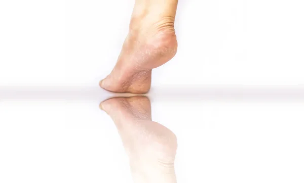 Zbliżenie jednej kobiecej nogi lub pięty pokazując suszone pęknięty Hee — Zdjęcie stockowe