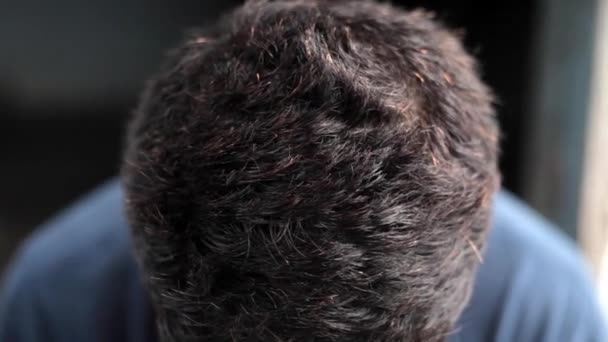 Vlas Bělošského Bílýho Teenagera Který Svrběný Černém Pozadí Nosí Modré — Stock video