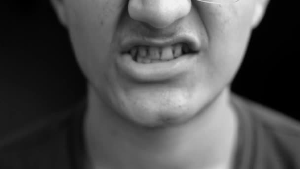 Unidentified Male Teenager Doing Various Face Expressions Mouth Teeth Sticking — Stock Video