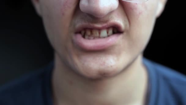 Kimliği Belirlenemeyen Genç Bir Erkek Ağzı Dişleriyle Çeşitli Yüz Ifadeleri — Stok video