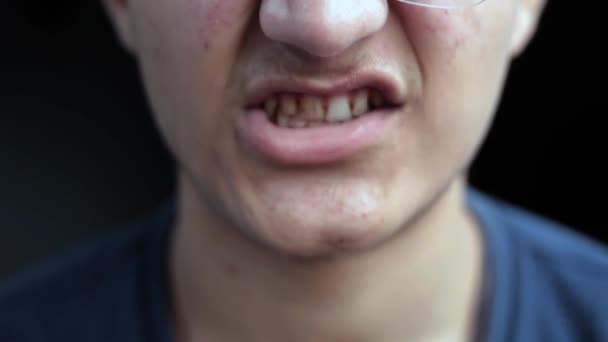 Unidentified Male Teenager Doing Various Face Expressions Mouth Teeth Sticking — 비디오