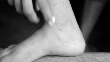 Ayak bileğindeki yarayı kapat ve bir el geliyor ve antiseptik krem sür..