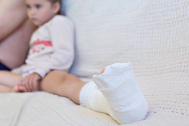 Kırık bacak. Ayağındaki alçıya yakın çekim. Kas onarma ve güçlendirme egzersizleri. Kemiklerde hasar var. Acil servisteki bir cerrahın tıbbi bakımı.