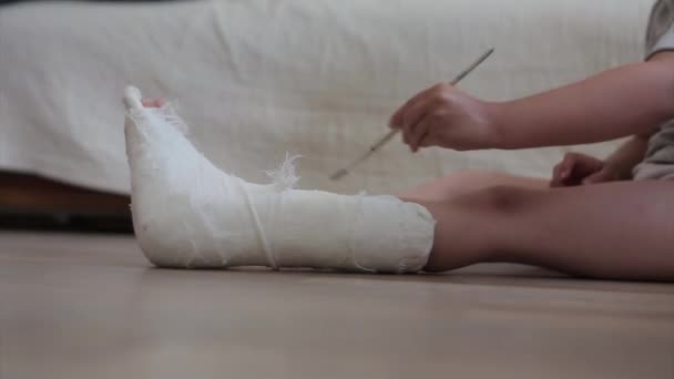 Сломана Нога Крупный План Гипса Ногах Упражнения Восстановления Укрепления Мышц — стоковое видео