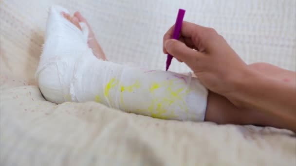 Picior Rupt Deteriorarea Oaselor Copil Pictează Tencuială Fată Marker — Videoclip de stoc