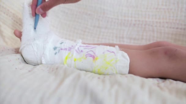 Złamana Noga Uszkodzenie Kości Dziecko Maluje Tynk Dziewczyna Markerem — Wideo stockowe