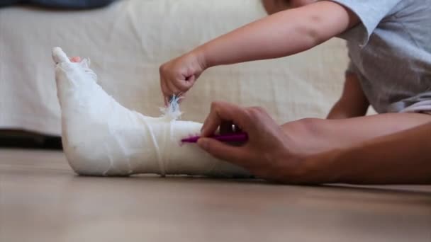 断腿了骨头受损了 一个小孩画石膏 一个有标记的女孩 — 图库视频影像