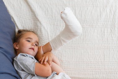 Kırık bacak. Ayağındaki alçıya yakın çekim. Kas onarma ve güçlendirme egzersizleri. Kemiklerde hasar var. Acil servisteki bir cerrahın tıbbi bakımı.