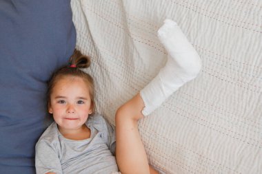 Kırık bacak. Ayağındaki alçıya yakın çekim. Kas onarma ve güçlendirme egzersizleri. Kemiklerde hasar var. Acil servisteki bir cerrahın tıbbi bakımı.