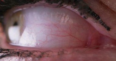 Gözler gergin bir şekilde etrafına bakıyor.