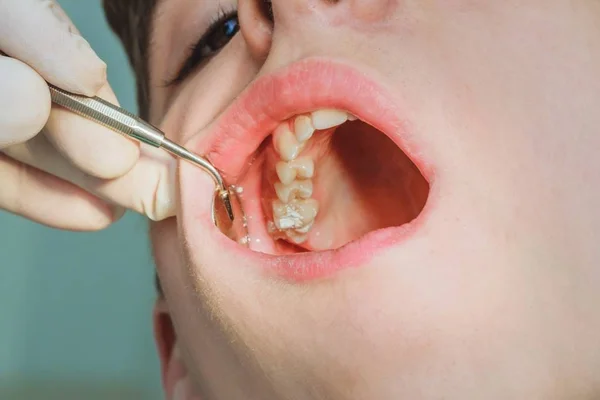 Dentista Dentário Menino Paciente Cuidados Médicos Higiene Profissional — Fotografia de Stock