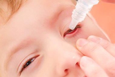 Göz çocuk alerji ve konjonktivit enfeksiyon kırmızı alerjisi, hasta iltihabı.