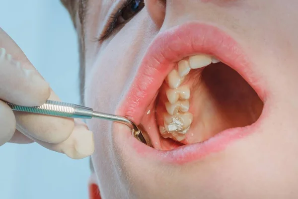 dental dentist boy patient medical care hygiene. oral.