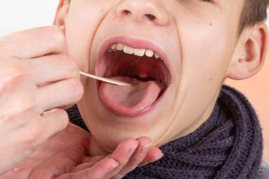 Çocuk çocuk boğaz doktor tıbbi kontrol, grip.