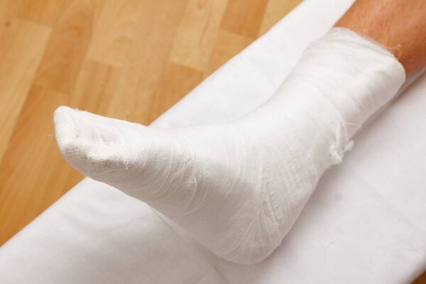 Сидящий мужчина травма ноги штукатурка, уход дома
.