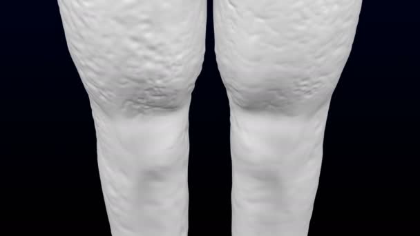 Die Beine einer Frau nehmen zu und verlieren an Gewicht. Schlupflöcher. luma matt. 3D-Darstellung.