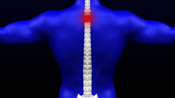 Rückenschmerzen. 3D-Darstellung. lizenzfreie Stockbilder