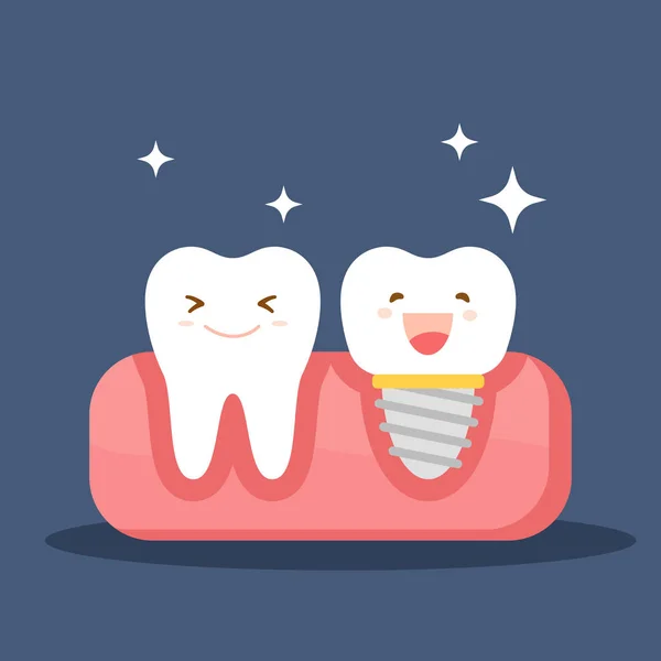 Dental implant ve normal bir diş. Oral kavite içinde restorasyon. Düz Illustration diş hekimliği tema. Vektör illüstrasyon izole mavi arka plan üzerinde. — Stok Vektör